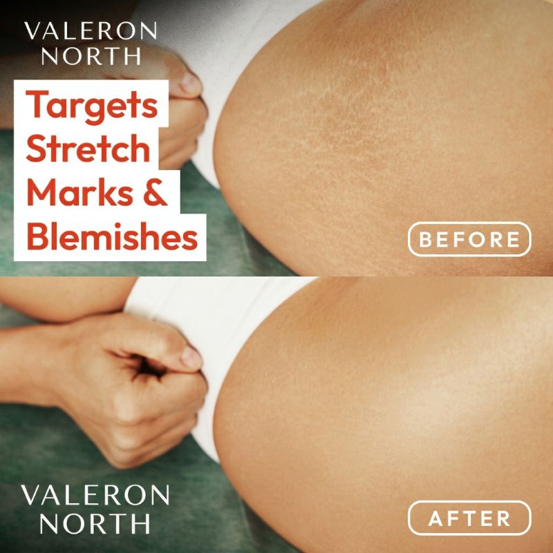 Valeron Magic Body Oil - 100ml