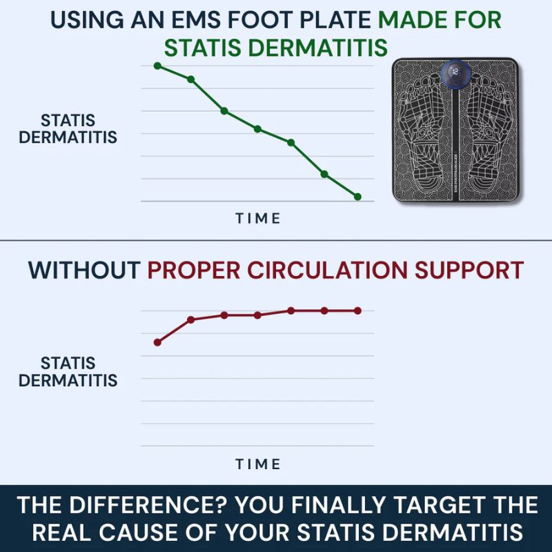 VALERON - EMS TREAT STASIS DERMATITIS FROM HOME