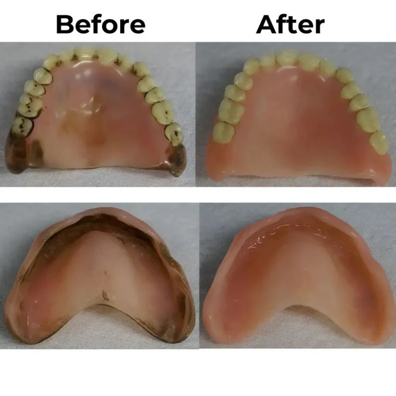 Product feature image